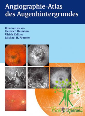 Angiographie-Atlas des Augenhintergrundes. Herausgegeben von Heinrich Heimann Ulrich Kellner Michael H. Foerster