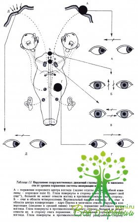 Нарушение содружественных движений глазных яблок в зависимости от уровня поражения системы иннервации взгляда