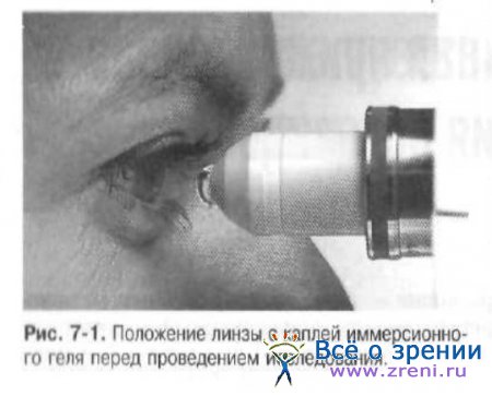 Конфокальная лазерная сканирующая микроскопия роговицы