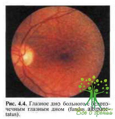 Клинические формы врожденных и наследственных заболеваний ретинального пигментного эпителия