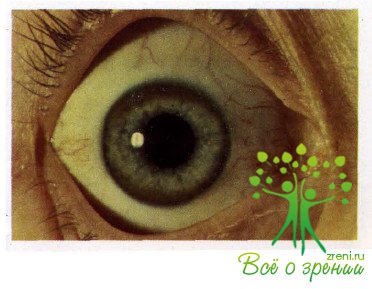 Атлас глазных болезней | Врожденная и врожденно-наследственная патология органа зрения (Чать 1)