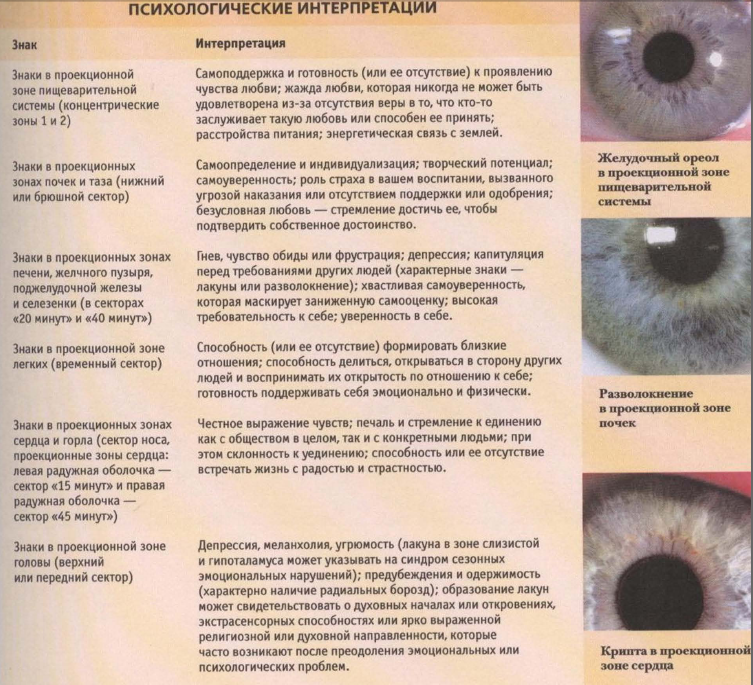 Как узнать какой болезнь. Болезни по радужке глаза. Определение болезней по глазам. Как по глазам определить болезни.