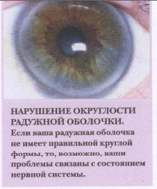 Оценка радужной оболочки своих глаз | Иридодиагностика