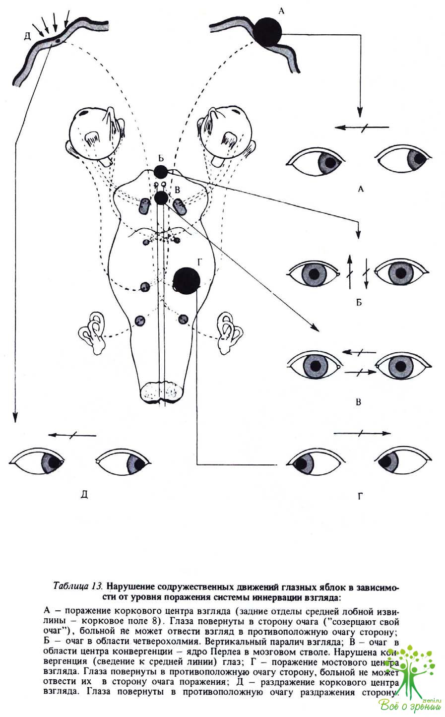 Нарушение движения глаз. Движения глазных яблок в неврологии. Нарушения движения глаз. Содружественное движение глаз.