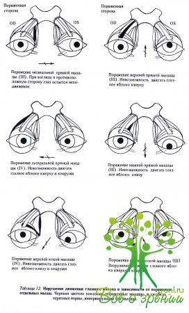 Нарушение движения глазного яблока в зависимости от поражения отдельных мышц
